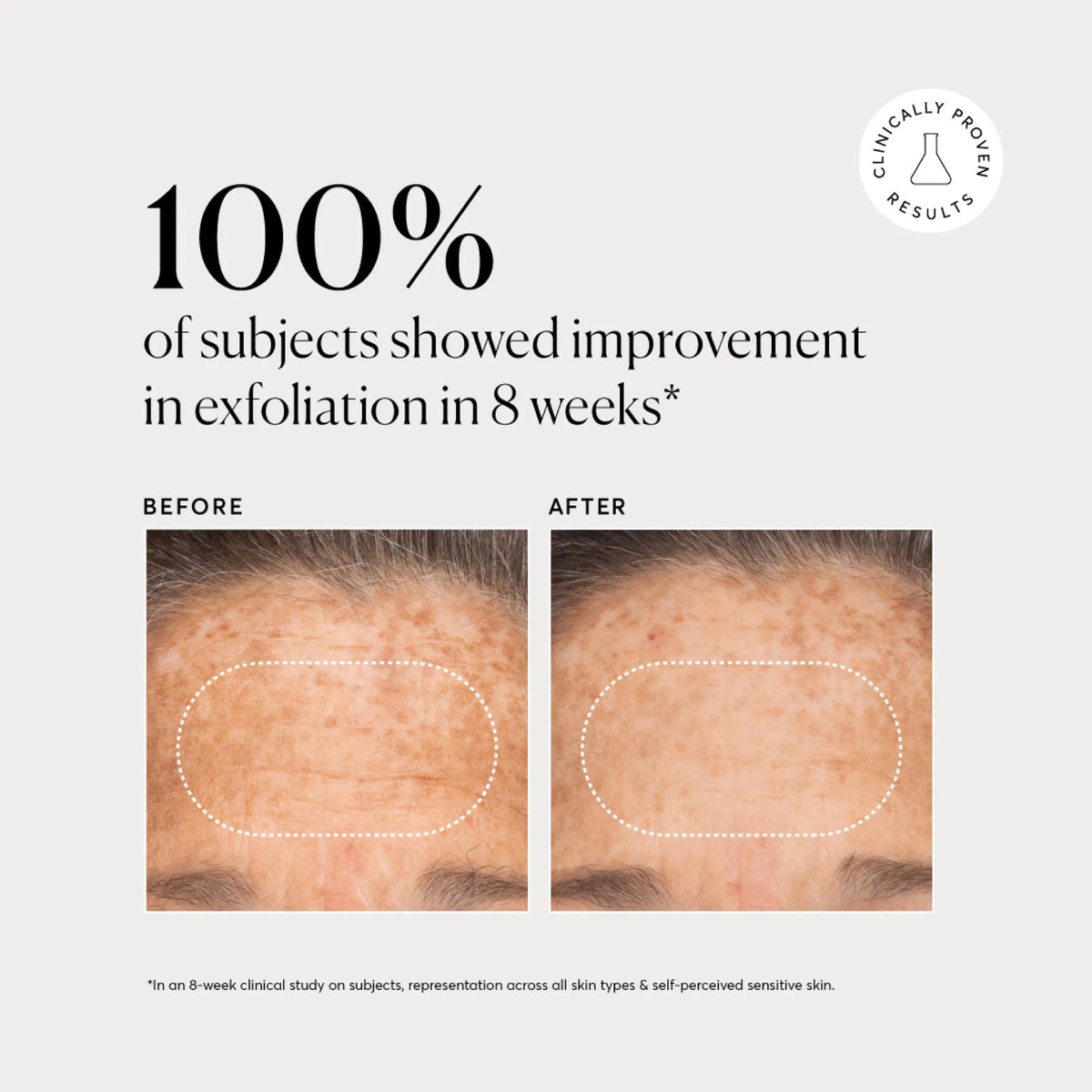bha-liquid-exfoliant-2-s5 NATR-10027-Alt-Images-BHA-Liquid-Exfoliant-2_-03.webp